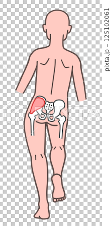 トレンデレンブルグ徴候の人体 125102061