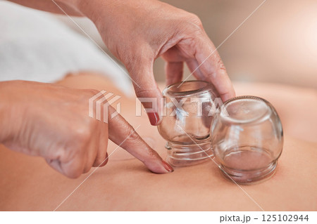 Cupping, therapy and back massage at a wellness, health and beauty spa at a self care resort. Healing, body care and hands of a therapist doing healthy treatment with vacuum glasses for stress relief Cupping, therapy and back massage at a wellness, health and beauty spa at a self care resort. Healing, body care and hands of a therapist doing healthy treatment with vacuum glasses for stress relief 125102944