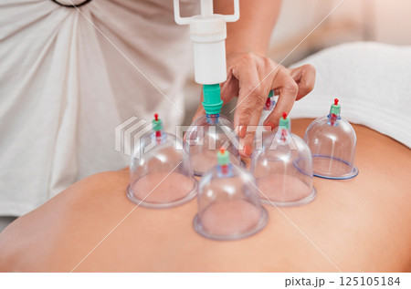 Spa, physiotherapy and cupping therapy with back of woman for relax, massage and beauty. Health, alternative medicine and holistic treatment with hands of therapist for healing, zen and wellness Spa, physiotherapy and cupping therapy with back of woman for relax, massage and beauty. Health, alternative medicine and holistic treatment with hands of therapist for healing, zen and wellness 125105184