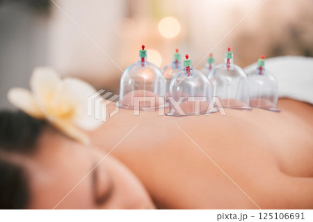 Cupping therapy, spa and zen woman for chinese alternative medicine treatment for back pain and health. Bodycare and wellness with cup therapy for stress relief, wellbeing wiith cups and heat on skin 125106691