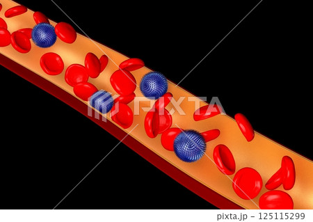 Vessel with red blood and virus cells - 3D illustration Vessel with red blood and virus cells - 3D illustration 125115299