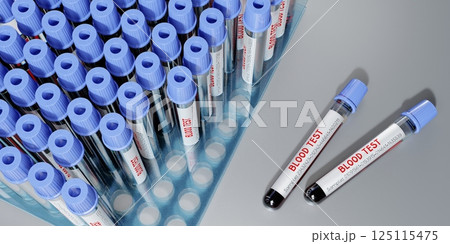Blood test, test tubes - 3D illustration Blood test, test tubes - 3D illustration 125115475