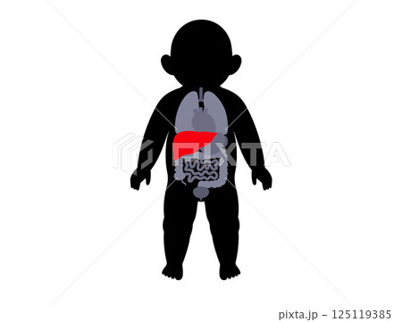 Liver diseases in a child 125119385