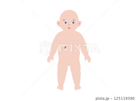 Gallbladder diseases in a child 125119390