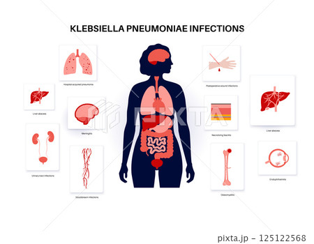 Klebsiella pneumoniae poster 125122568