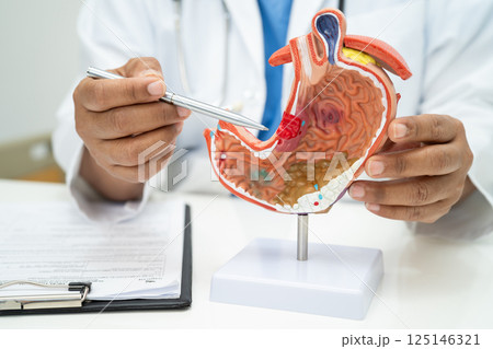 Stomach disease, doctor with human anatomy model for study diagnosis and treatment in hospital. Stomach disease, doctor with human anatomy model for study diagnosis and treatment in hospital. 125146321