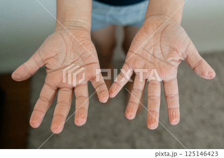 Pruney hands displayed with palms open, showcasing the effect of prolonged water immersion. Skin appears wrinkled and textured, highlighting a common physiological reaction. Pruney hands displayed with palms open, showcasing the effect of prolonged water immersion. Skin appears wrinkled and textured, highlighting a common physiological reaction. 125146423