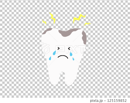 一顆牙齒有多處蛀牙：一個簡單的例子 125159852