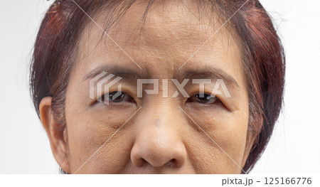Flabby and wrinkled skin on senior woman face. Flabby and wrinkled skin on senior woman face. 125166776