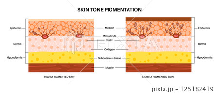 Melanin and melanocytes Melanin and melanocytes 125182419