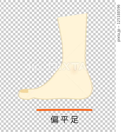偏平足のイラスト 125188596