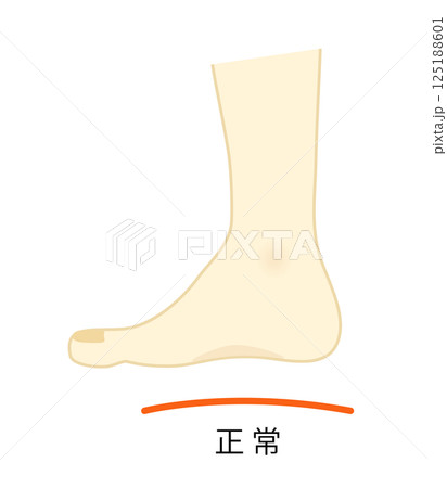 正常な土踏まずのある足のイラスト 125188601