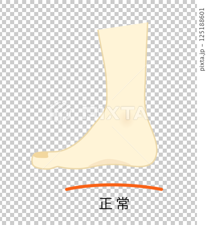 正常な土踏まずのある足のイラスト 125188601