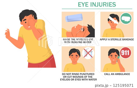 Rinse the affected eye with water, apply a sterile bandage, and call for emergency help if needed. Learn important first aid procedures for eye injuries effectively 125195071