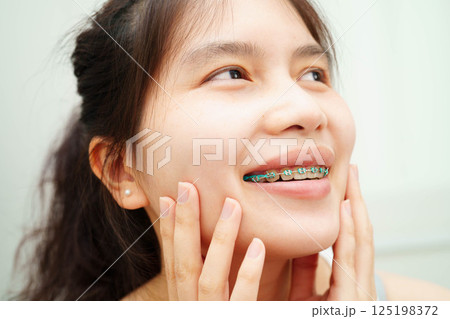 Asian woman with dental braces orthodontic treatment dental care. 125198372