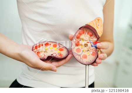 Chronic kidney disease, Asian woman with model for treatment urinary system, urology, Estimated glomerular filtration rate eGFR. 125198416