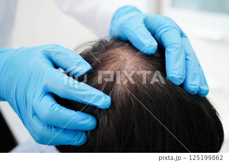 Doctor touch bold head in man, hair loss treatment health problem. Doctor touch bold head in man, hair loss treatment health problem. 125199862