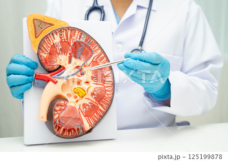 Chronic kidney disease, doctor with model for treatment urinary system, urology, Estimated glomerular filtration rate eGFR. 125199878