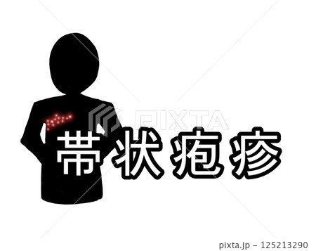 病名「帯状疱疹」 125213290