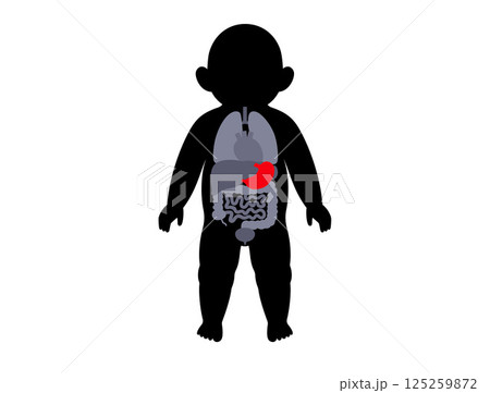 Stomach diseases in a child 125259872