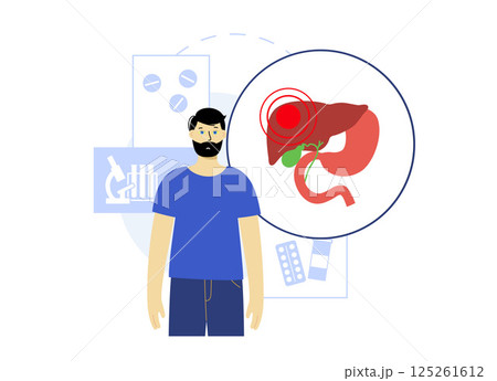 Jaundice yellow skin Jaundice yellow skin 125261612