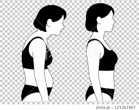 駝背與正確姿勢對比 125261967