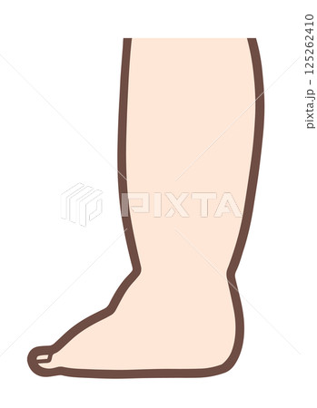 むくんだ足 125262410