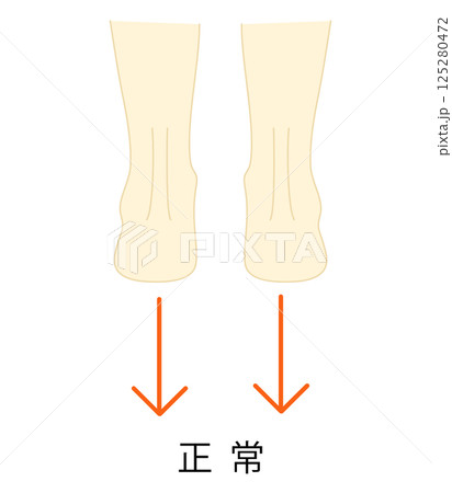 これは正常な足のイラストです。 これは正常な足のイラストです。 125280472