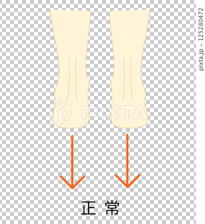 これは正常な足のイラストです。 これは正常な足のイラストです。 125280472