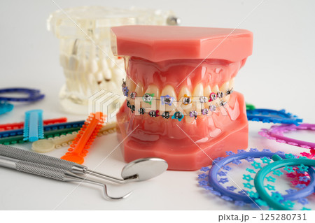 Orthodontic ligatures rings and ties, elastic rubber bands on orthodontic braces, model for dentist studying about dentistry. 125280731