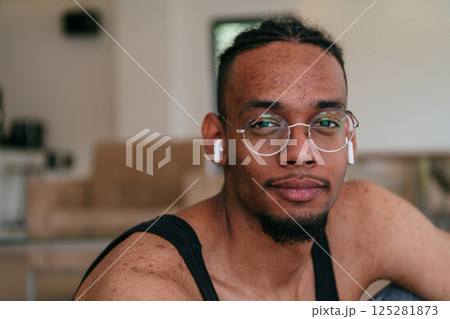 A headshot of an African American man with glasses and headphones, his face covered in severe acne, sitting on the living room floor. 125281873