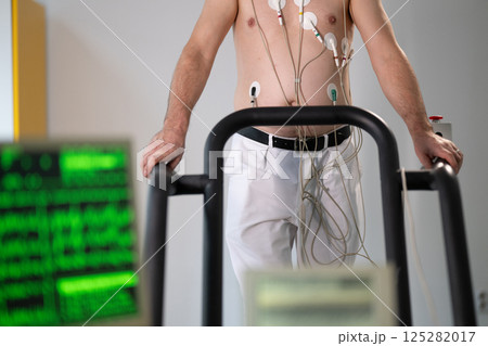 A middle-aged man is undergoing a medical stress test on a treadmill, connected to ECG electrodes for heart monitoring in a clinical environment A middle-aged man is undergoing a medical stress test on a treadmill, connected to ECG electrodes for heart monitoring in a clinical environment 125282017