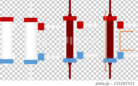 Dialysis illustration 125287553