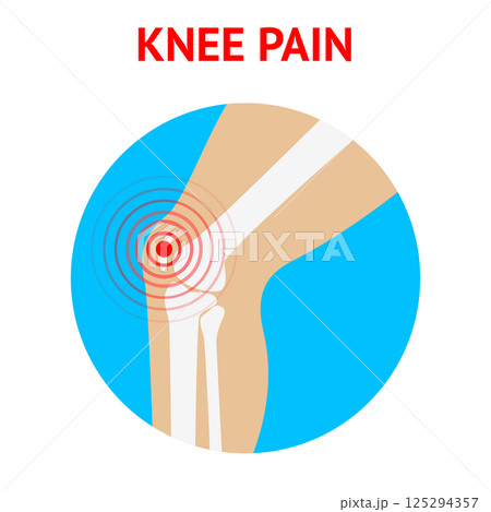 Knee pain. Knee pain icon isolated on white background. Human knee. Vector design element. Knee pain. Knee pain icon isolated on white background. Human knee. Vector design element. 125294357