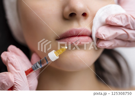 lip shape correction procedure in a cosmetology salon. The specialist makes an injection on the lips of the patient. Lip augmentation. 125308750