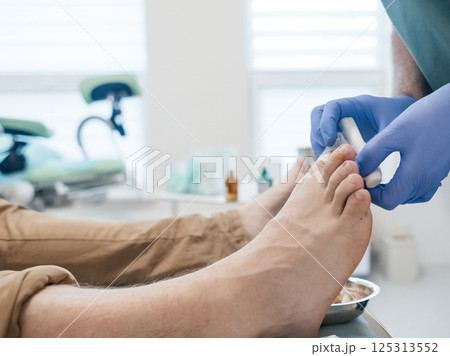 Resection of the nail plate, removal of ingrown nail. Dressing after surgery on the toe. Surgical treatment of onychocryptosis, paronychia and purulent disease Resection of the nail plate, removal of ingrown nail. Dressing after surgery on the toe. Surgical treatment of onychocryptosis, paronychia and purulent disease 125313552