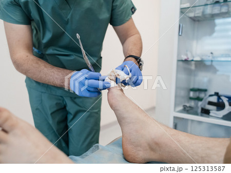 Resection of the nail plate, removal of ingrown nail. Dressing after surgery on the toe. Surgical treatment of onychocryptosis, paronychia and purulent disease Resection of the nail plate, removal of ingrown nail. Dressing after surgery on the toe. Surgical treatment of onychocryptosis, paronychia and purulent disease 125313587