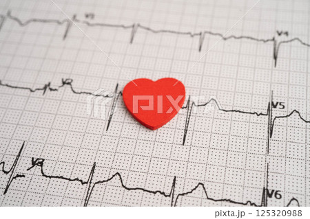 Electrocardiogram ECG heart wave, heart attack, cardiogram report. Electrocardiogram ECG heart wave, heart attack, cardiogram report. 125320988