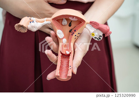 Uterus, Asian, woman holding human anatomy model. 125320990