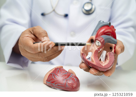 Cardiovascular disease CVD, doctor with heart human model anatomy for treatment patient in hospital. 125321059