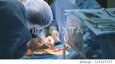 Team of surgery doctors operating a patient in surgical room. Healthcare and medical aid concept 125327137