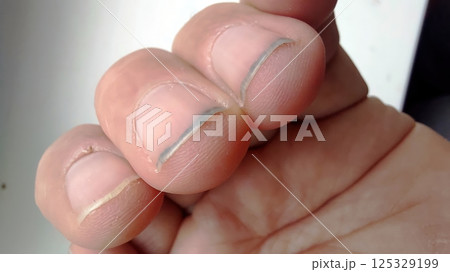 Hand shows dirt and grime under fingernails after outdoor work without gloves in the early afternoon 125329199