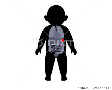 Spleen diseases in a child 125333613