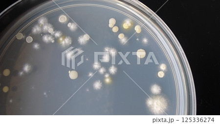 細菌と酵母菌とカビが混ざったシャーレ 細菌と酵母菌とカビが混ざったシャーレ 125336274