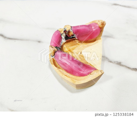 Dental partial denture frame 125338184