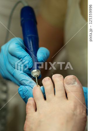 Technician precisely cleans toenails using a slim electric drill bit. 125359996