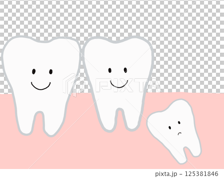 歯の成長・生え変わり:埋没歯・埋伏歯のあるイラスト・主線あり 歯の成長・生え変わり:埋没歯・埋伏歯のあるイラスト・主線あり 125381846