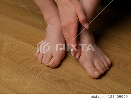 Close-up of a woman s foot with hallux valgus bunion and signs of toenail fungus. Her hand gently touches the deformed big toe, illustrating common foot problems and the need for medical care. 125409999
