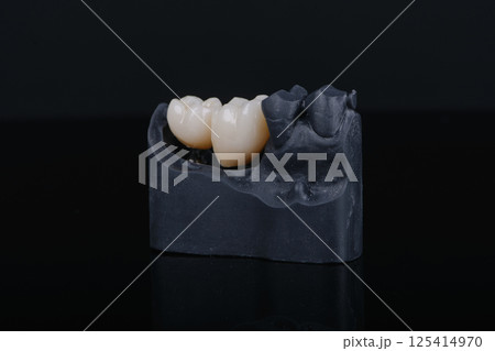 Two dental crowns made of zirconium on titanium abutments for fixation to implant 125414970