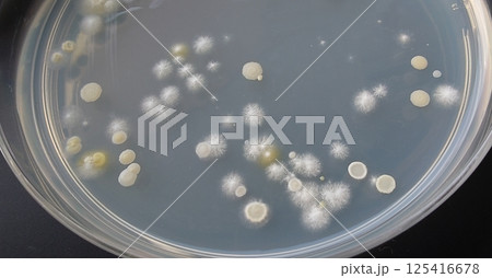 落下細菌の様子 125416678